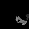 SPORK, NICO - 22.03.1976 - 02.08.2022 - CT obere Extremität - 17:51:17